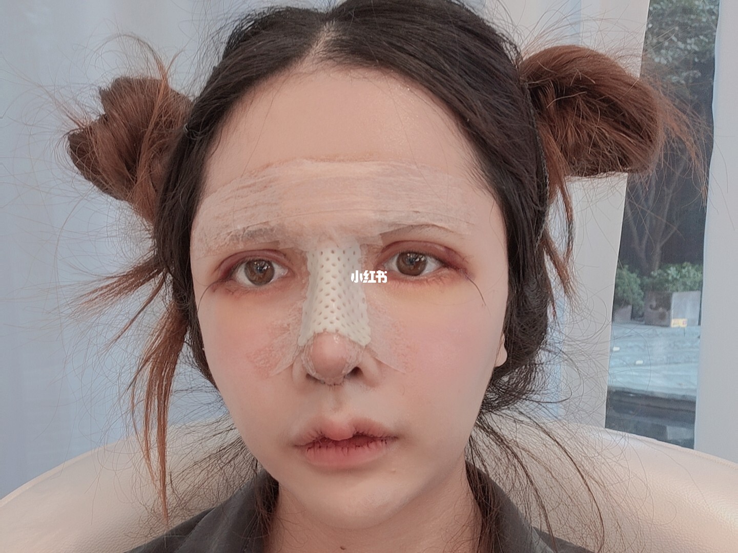廉价纸擦脸肿成猪头